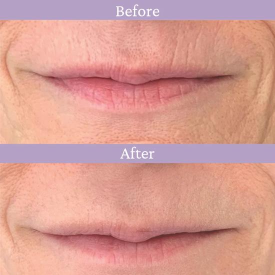 PRAI Ageless Lip Line Filler 4ml