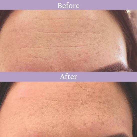 PRAI Ageless Lip Line Filler 4ml